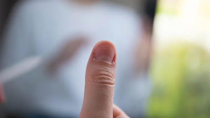 Close do polegar de uma mão, região onde a sensação de agulhadas no dedo da mão costuma aparecer